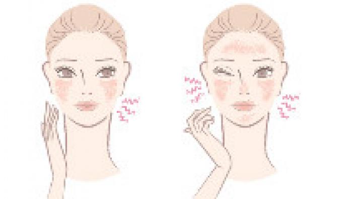 Best Remedies For Facial Oily Skin